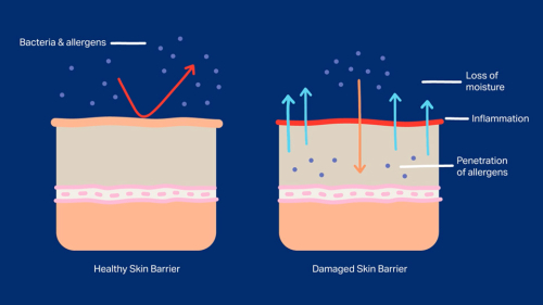 Unlock the Secrets of Skin Barrier Function: Repair and Care Guide