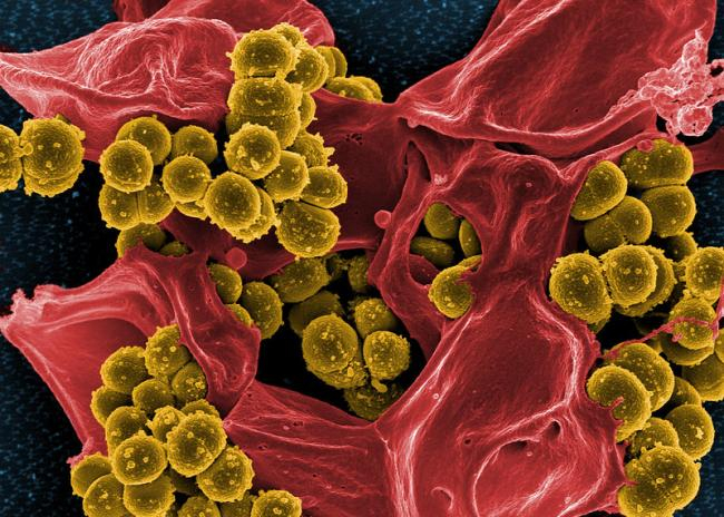 Discover how Two-dose therapy for S. aureus bloodstream infections matches standard treatment